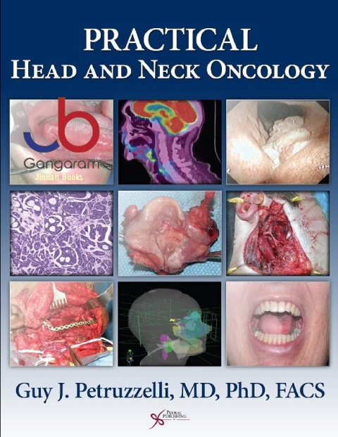 Practical Head and Neck Oncology