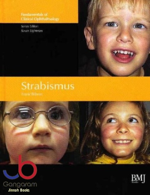 Strabismus Fundamentals of Clinical Opthalmology