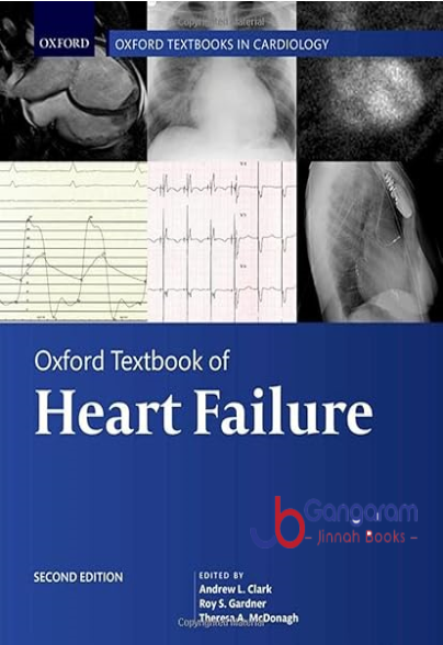 Oxford-Textbook-of-Heart-Failure-Oxford-Textbooks-in-Cardiology-2nd-Edition.