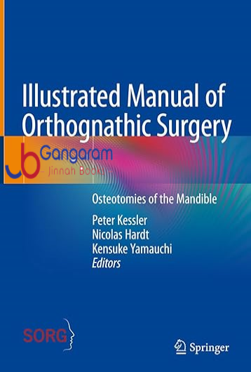 Illustrated-Manual-of-Orthognathic-Surgery-Osteotomies-of-the-Mandible