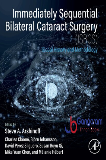 Immediately-Sequential-Bilateral-Cataract-Surgery-ISBCS-Global-History-and-Methodology