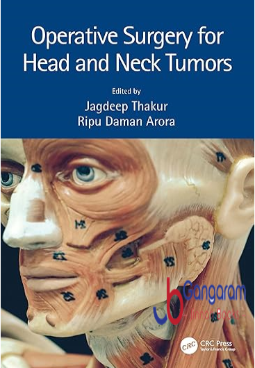 Operative-Surgery-for-Head-and-Neck-Tumors-1st-Edition