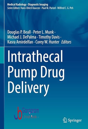Intrathecal-Pump-Drug-Delivery-Medical-Radiology