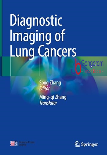 Diagnostic-Imaging-of-Lung-Cancers