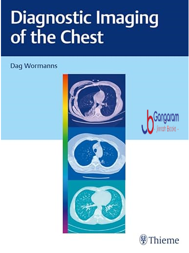 Diagnostic-Imaging-of-the-Chest