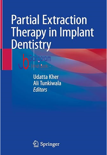 Partial-Extraction-Therapy-in-Implant-Dentistry