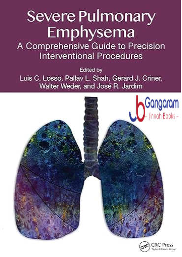 Severe-Pulmonary-Emphysema-A-Comprehensive-Guide-to-Precision-Interventional-Procedures