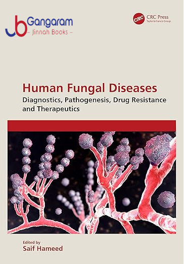 Human-Fungal-Diseases-Diagnostics-Pathogenesis-Drug-Resistance-and-Therapeutics-1st-Edition