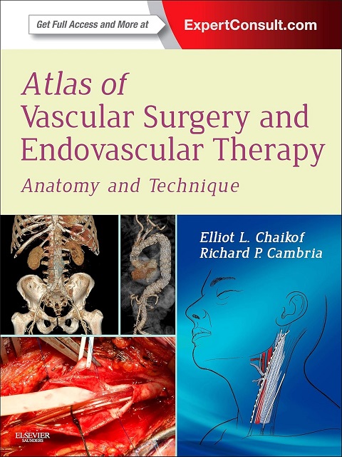 Atlas of Vascular Surgery and Endovascular Therapy Anatomy and Technique 1st Edition