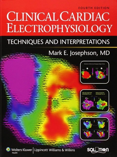 Clinical Cardiac Electrophysiology Techniques and Interpretations