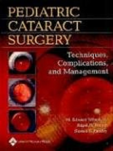 Pediatric Cataract Surgery Techniques, Complications, And Management