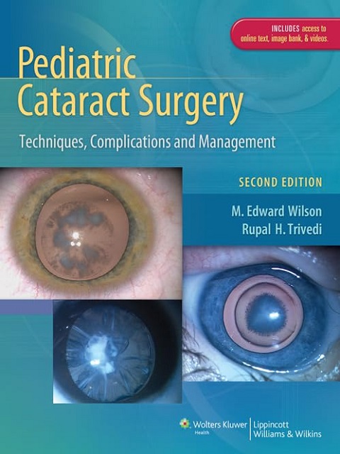 Pediatric Cataract Surgery Techniques, Complications and Management