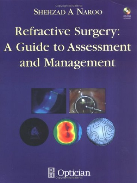 Refractive Surgery A Guide to Assessment and Management