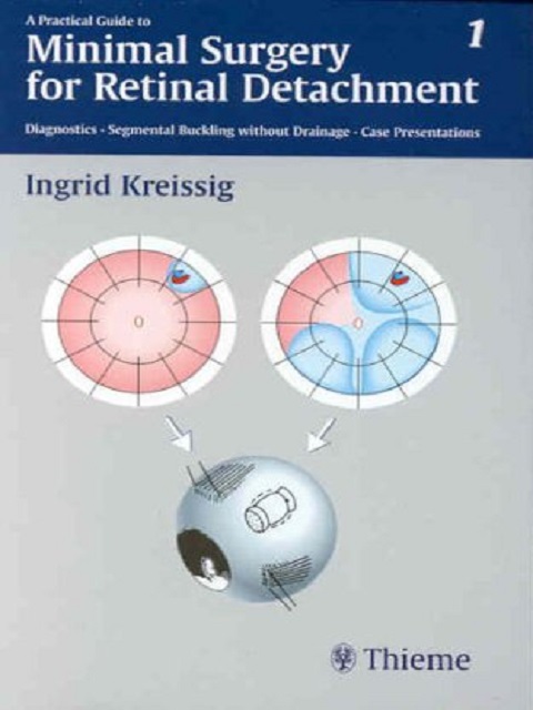 A Practical Guide to Minimal Surgery for Retinal Detachment, Volume 1 Diagnostics, Segmental Buckling Without Drainage, Case Presentations